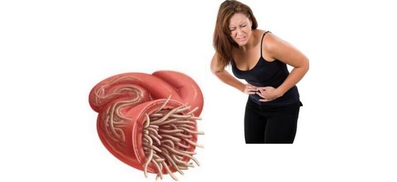 dureri abdominale datorate paraziților din intestine